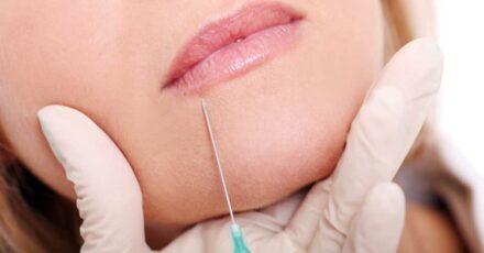 relleno de labios leganés