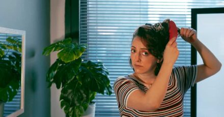 alopecia por estres