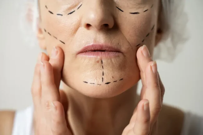cirugia estetico facial leganes